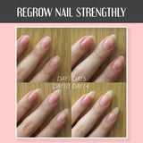 【LAST DAY SALE】NailShield™ - Nail Repair Protection Gel