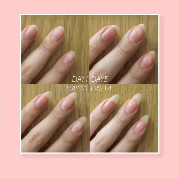 【LAST DAY SALE】NailShield™ - Nail Repair Protection Gel