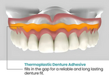 Thermoplastic Denture Adhesive