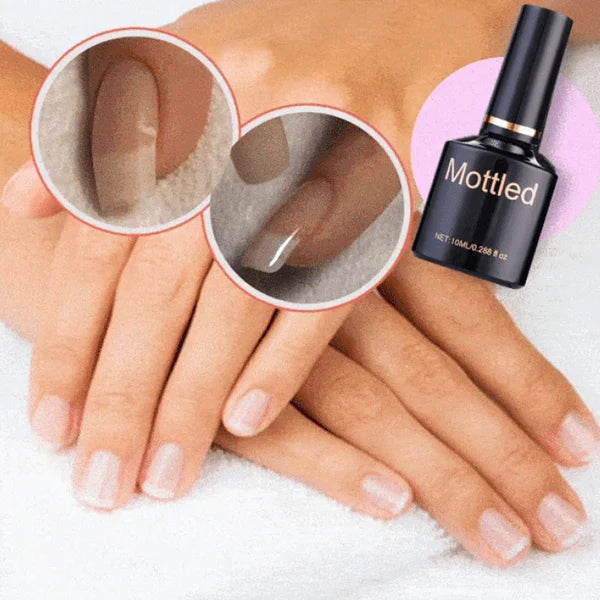 【LAST DAY SALE】NailShield™ - Nail Repair Protection Gel