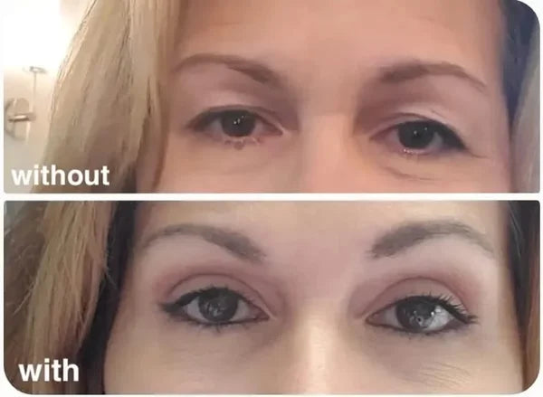 【LAST DAY SALE】LiftMagic™ - Natural Invisible Upper EyeLid-Lifting Strips