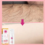 【LAST DAY SALE】HairAway™ - Rapid Hair Removal Spray