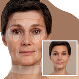 【LAST DAY SALE】AgeDefy™ - Anti-Wrinkle Face Patches