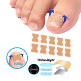 【LAST DAY SALE】Easy Patches™ - Correction Patches For Beautiful And Healthy Nails