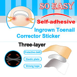 【LAST DAY SALE】Easy Patches™ - Correction Patches For Beautiful And Healthy Nails