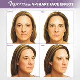 【LAST DAY SALE】Invisible face lifter tape