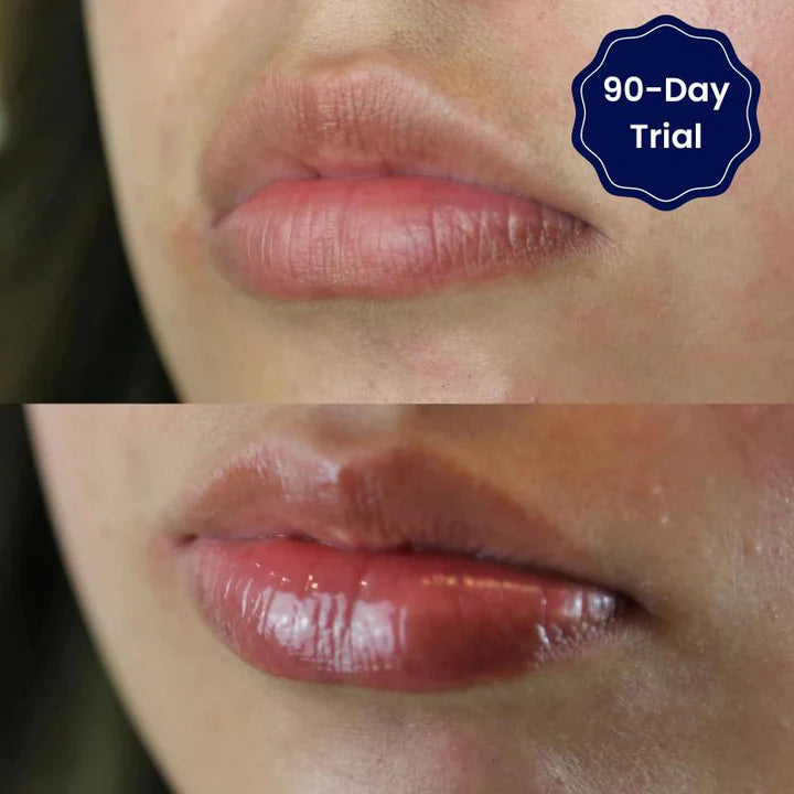 【LAST DAY SALE】Vitamin E Lip Plumping Serum (50% OFF)