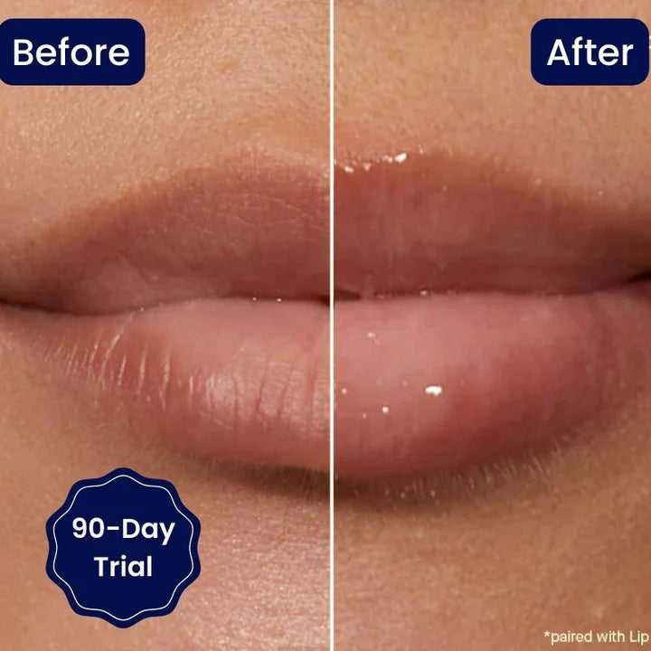 【LAST DAY SALE】Vitamin E Lip Plumping Serum (50% OFF)