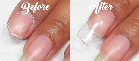 【LAST DAY SALE】NailPerfX™ - Nail Enhancer Care and Beautification Kit