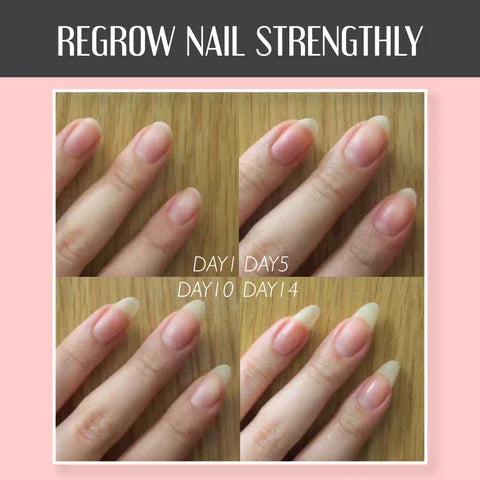 【LAST DAY SALE】NailShield™ - Nail Repair Protection Gel