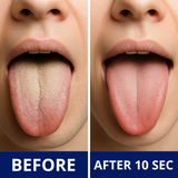 【LAST DAY SALE】Probiotic Tongue Cleaning Gel Set
