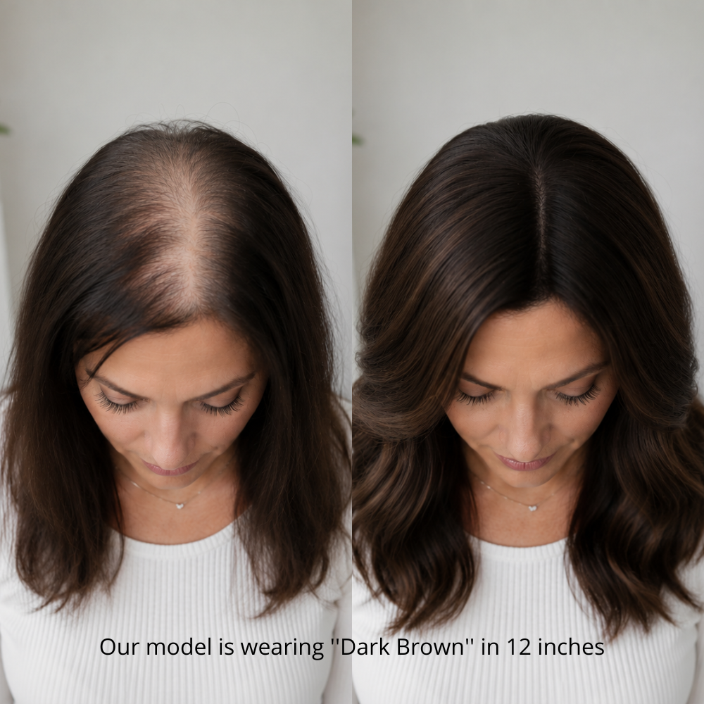 7" x 6" NOMARDIC Premium Lace Front Hair Topper