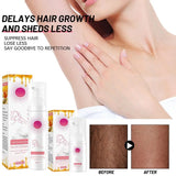 【LAST DAY SALE】HairAway™ - Rapid Hair Removal Spray