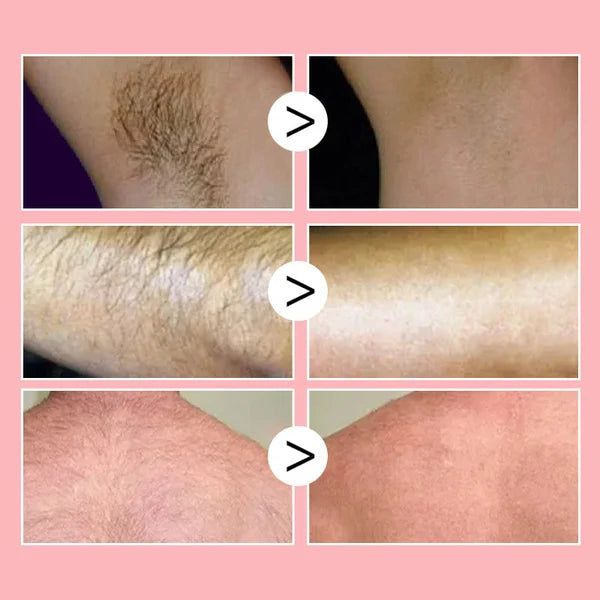 【LAST DAY SALE】HairAway™ - Rapid Hair Removal Spray