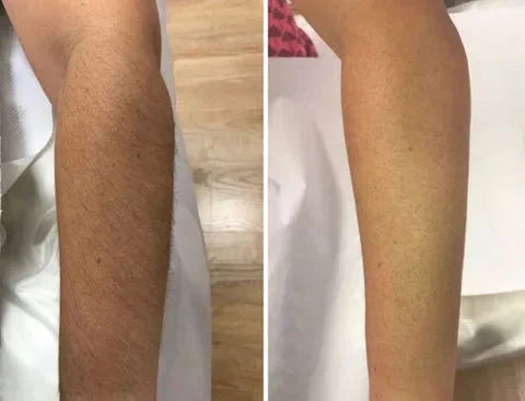 【LAST DAY SALE】HairAway™ - Rapid Hair Removal Spray