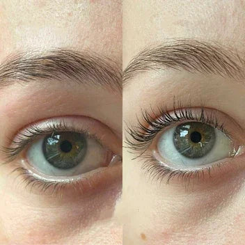 【LAST DAY SALE】Eyelash Active Serum For Longer & Fuller Lashes (Buy 1 Get 1 Free)