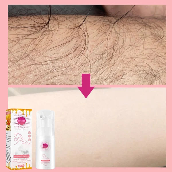 【LAST DAY SALE】HairAway™ - Rapid Hair Removal Spray