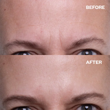 【LAST DAY SALE】AgeDefy™ - Anti-Wrinkle Face Patches