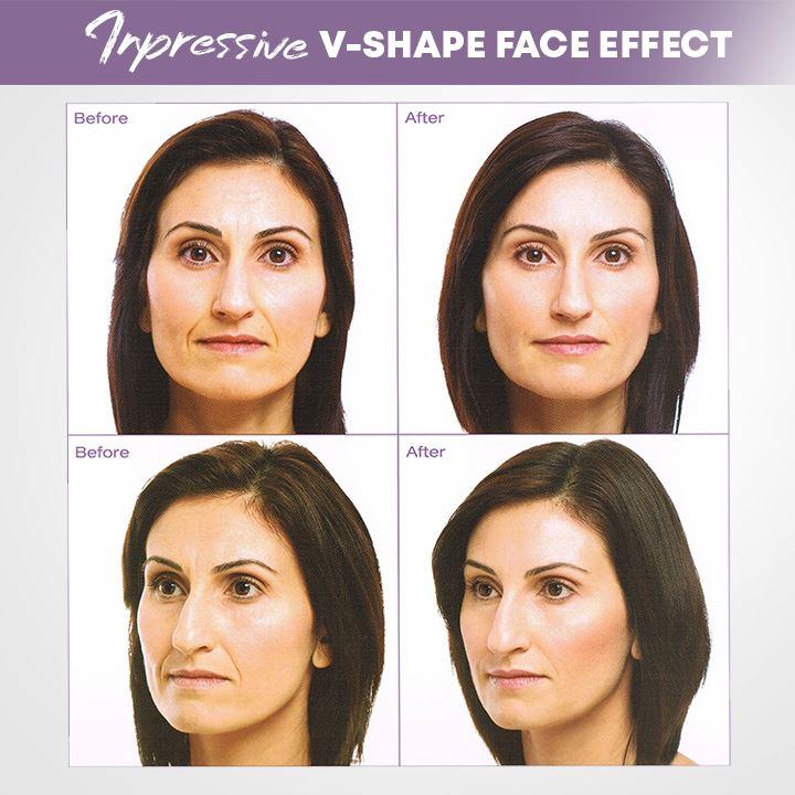 【LAST DAY SALE】Invisible face lifter tape