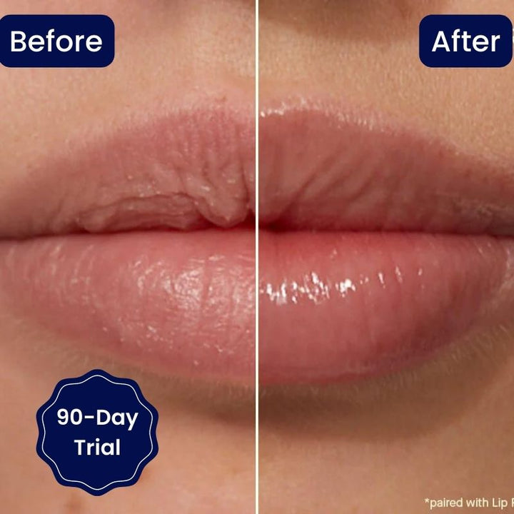【LAST DAY SALE】Vitamin E Lip Plumping Serum (50% OFF)