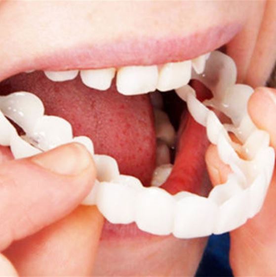 【LAST DAY SALE】Snap-on teeth™ - Always the perfect smile with these veneers