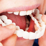 【LAST DAY SALE】Snap-on teeth™ - Always the perfect smile with these veneers